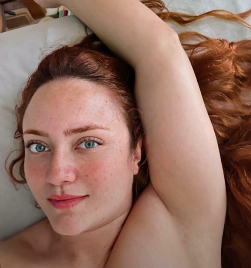 The only thing im wearing it’s my freckles